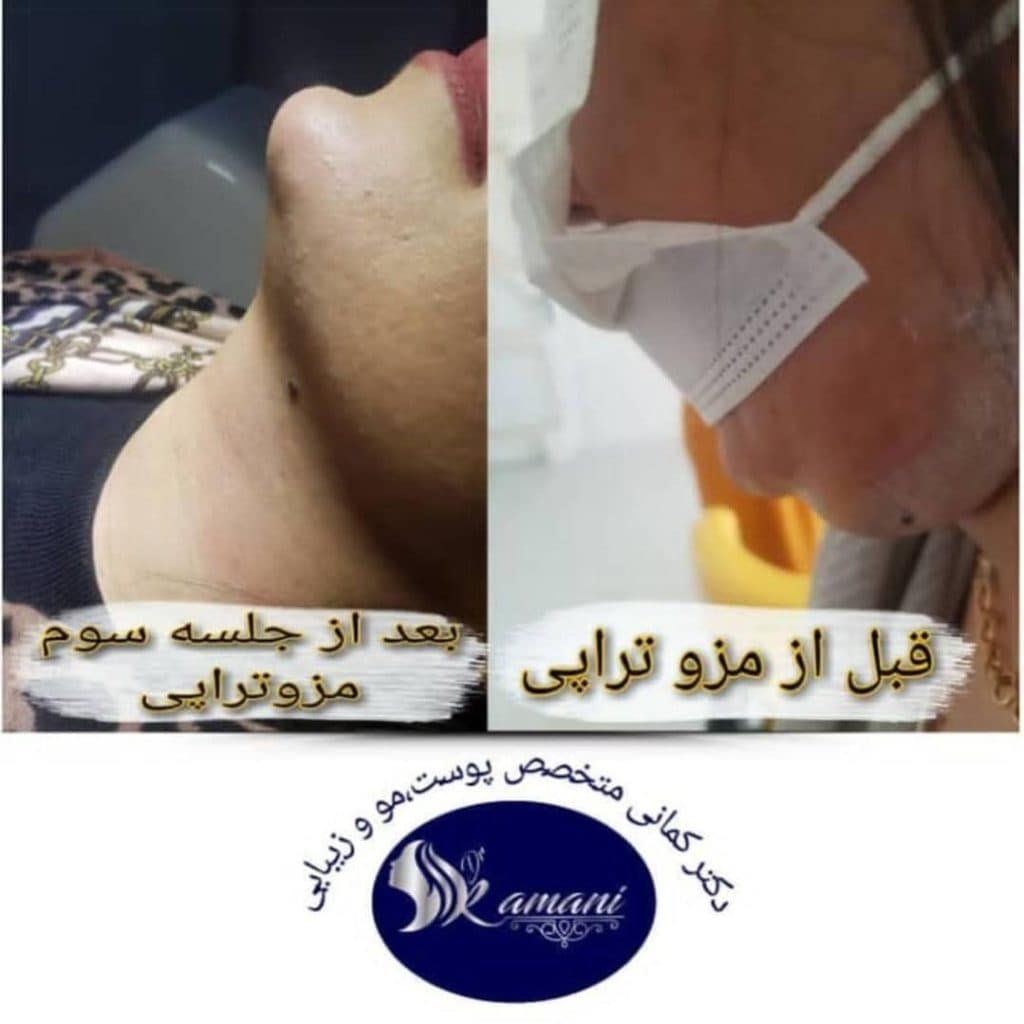 کلینیک تخصصی پوست مو زیبایی و لیزر متخصص پوست دکتر کمانی در شیراز