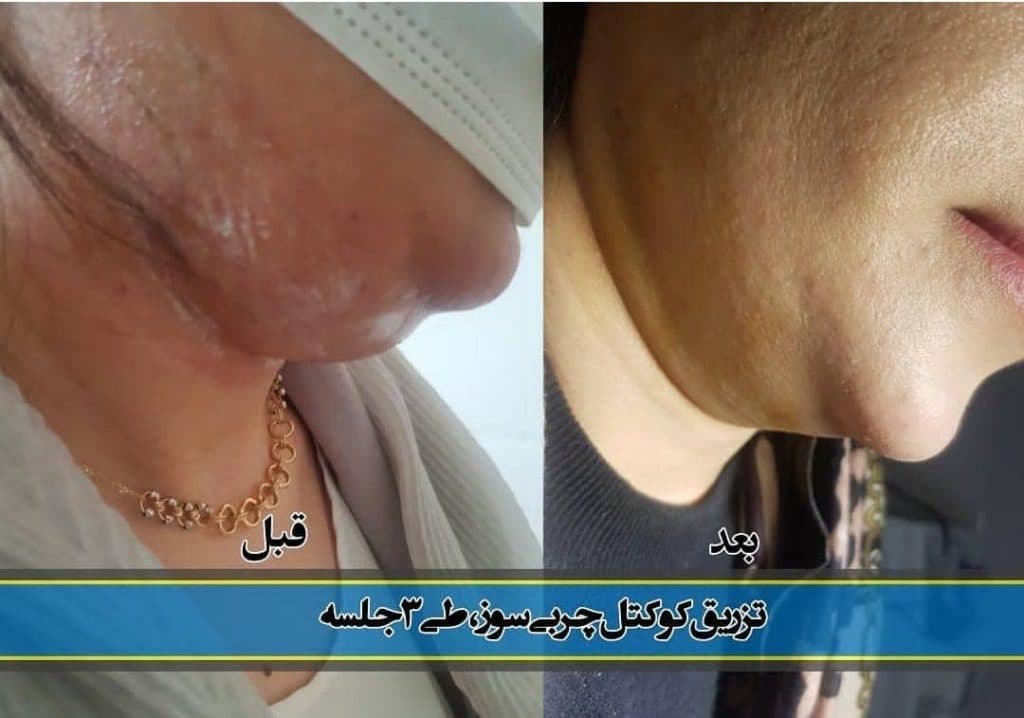 کلینیک تخصصی پوست مو زیبایی و لیزر متخصص پوست دکتر کمانی در شیراز