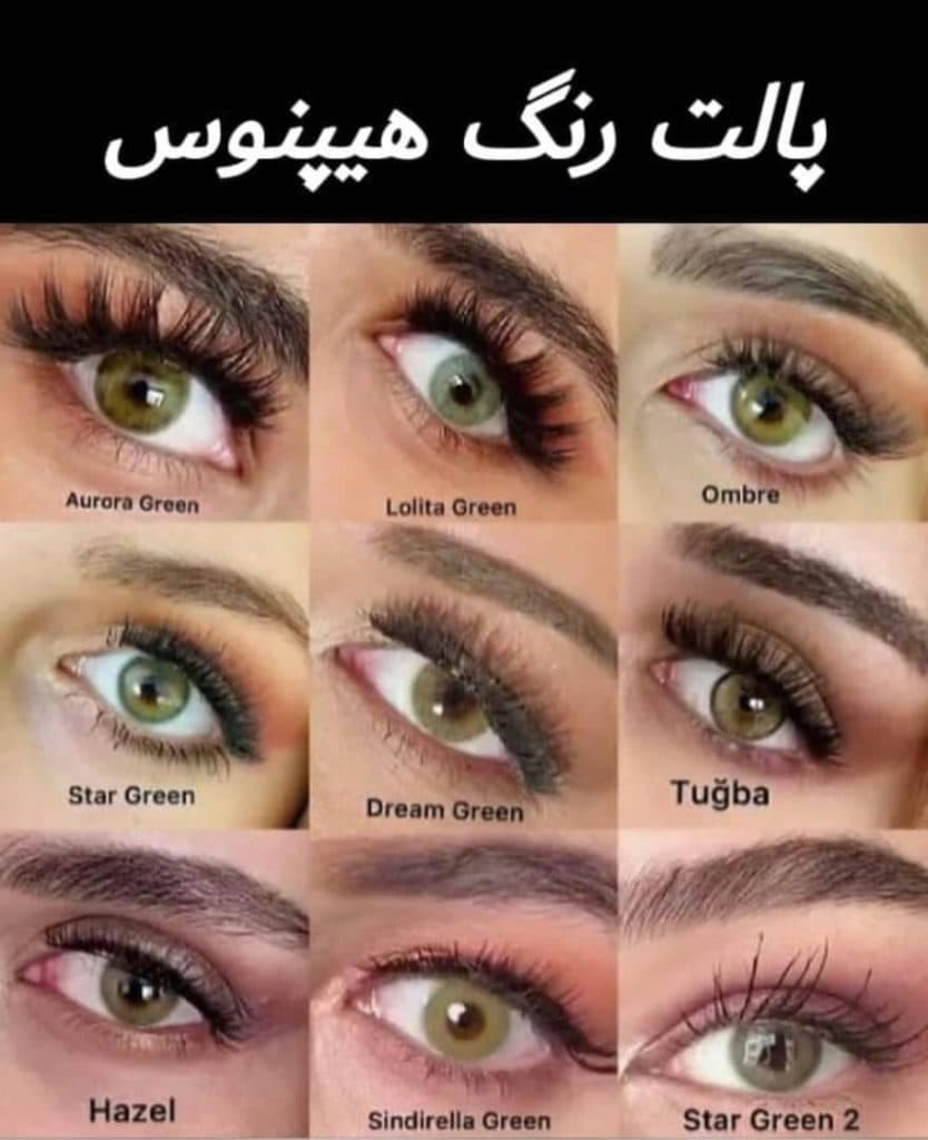 مطب بینایی سنجی لنز دیدگان در تهران