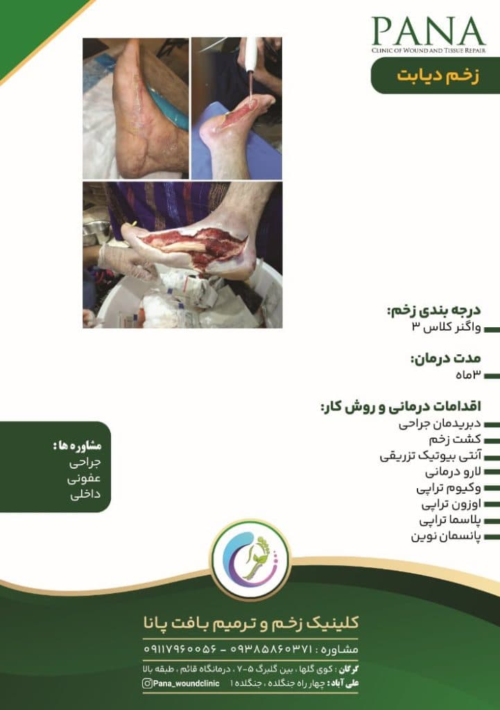 کلینیک زخم و ترمیم بافت پانا در گرگان گلستان