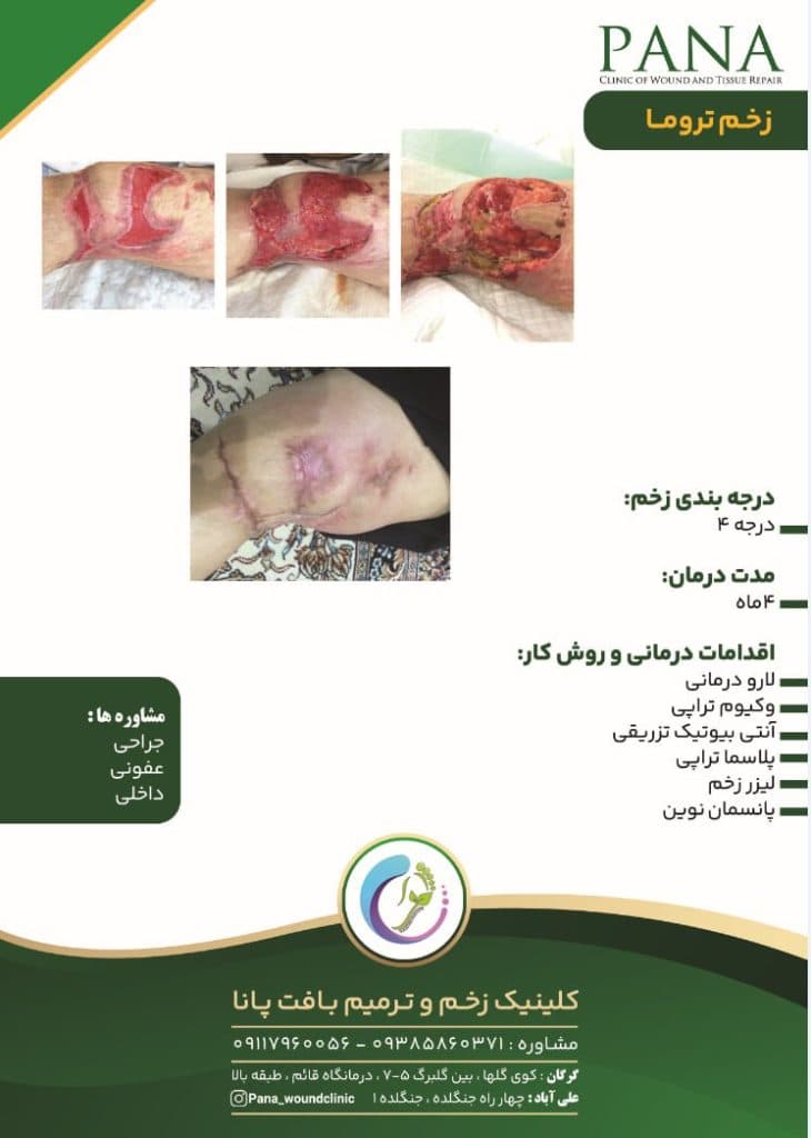 کلینیک زخم و ترمیم بافت پانا در گرگان گلستان