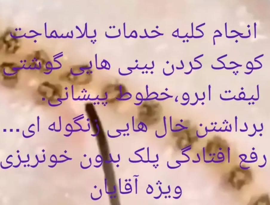 سالن زیبایی vip مردانه سیاه سفید در ملایر