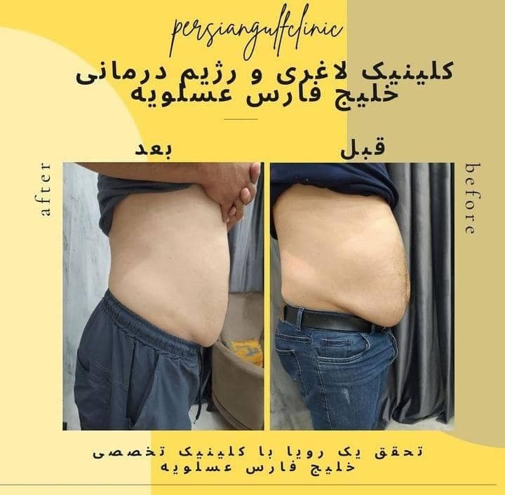 کلینیک تخصصی لاغری و تناسب اندام خلیج فارس در عسلویه