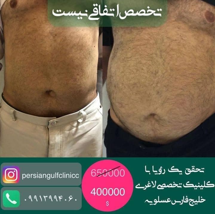 کلینیک تخصصی لاغری و تناسب اندام خلیج فارس در عسلویه
