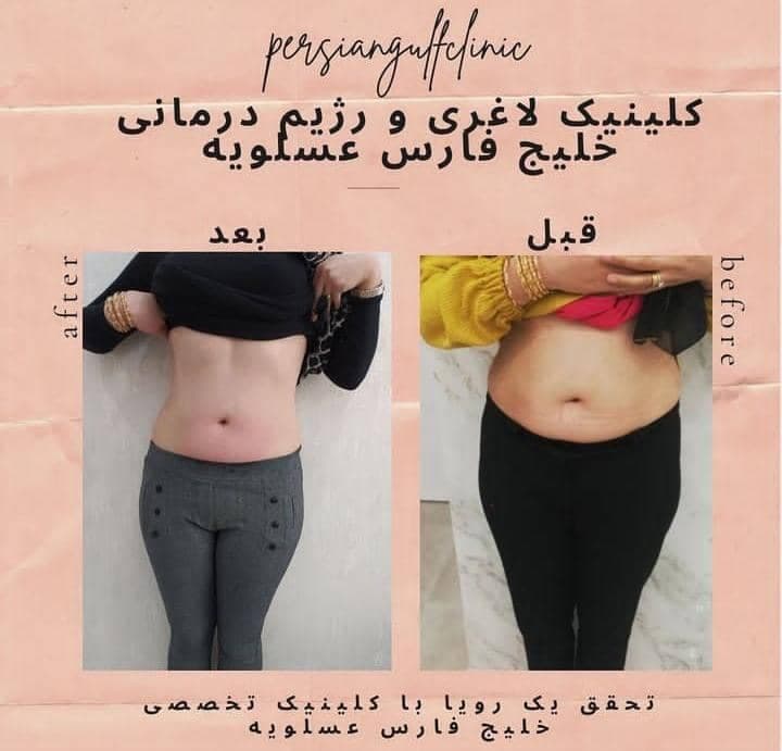 کلینیک تخصصی لاغری و تناسب اندام خلیج فارس در عسلویه