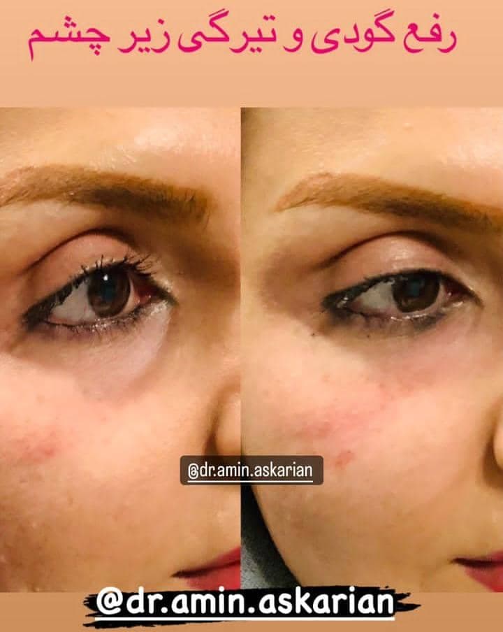 کلینیک زیبایی پوست مو و لیزر دکتر امین عسکریان در شیراز