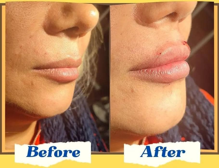 کلینیک تخصصی زیبایی لیفت نخ و طب سوزنی نبضی نو در تهران