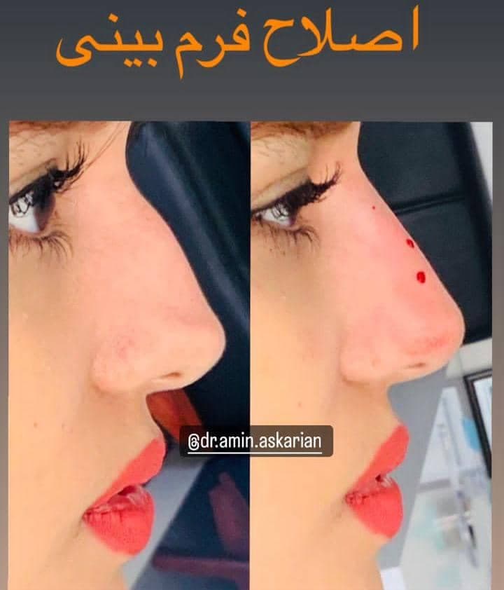 کلینیک زیبایی پوست مو و لیزر دکتر امین عسکریان در شیراز