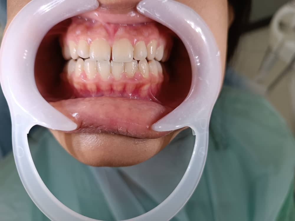 مطب دندانپزشکی لمینت و کامپوزیت دندان ویانا در بندرعباس