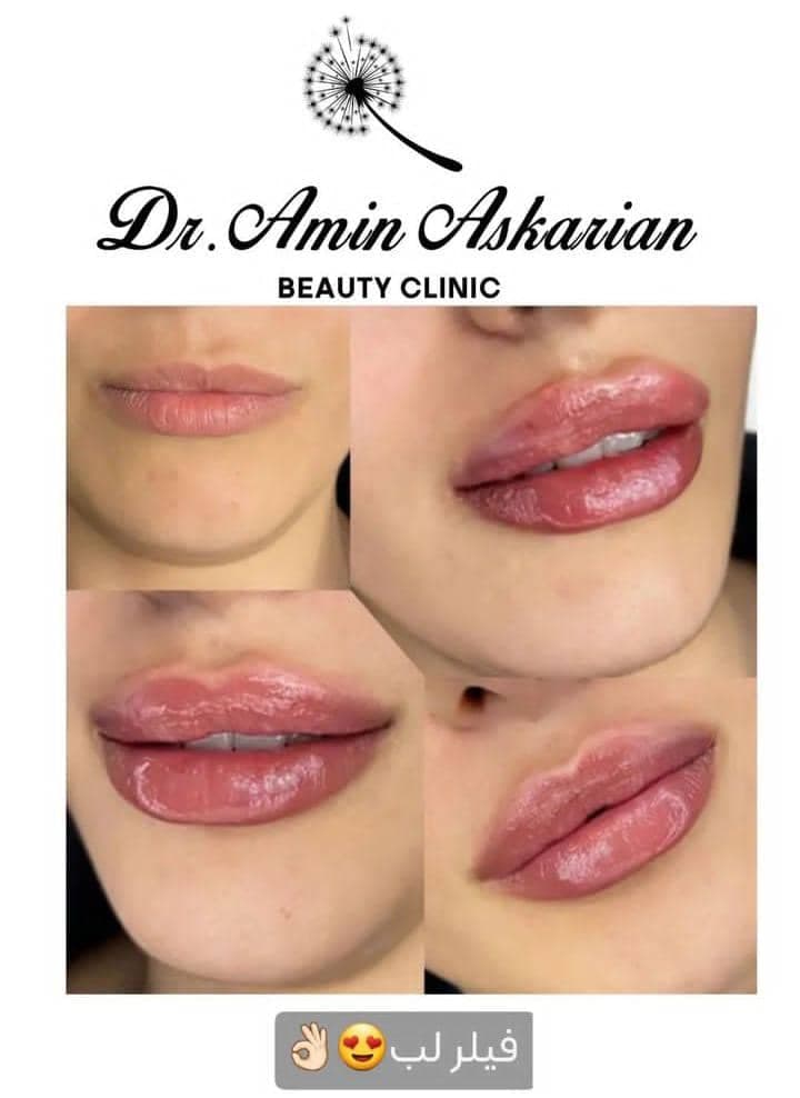 کلینیک زیبایی پوست مو و لیزر دکتر امین عسکریان در شیراز