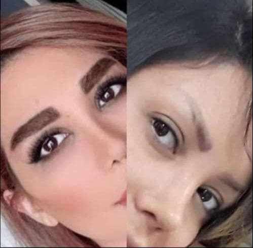 خدمات تخصصی کاشت مو و ابرو شیروانی در سنندج