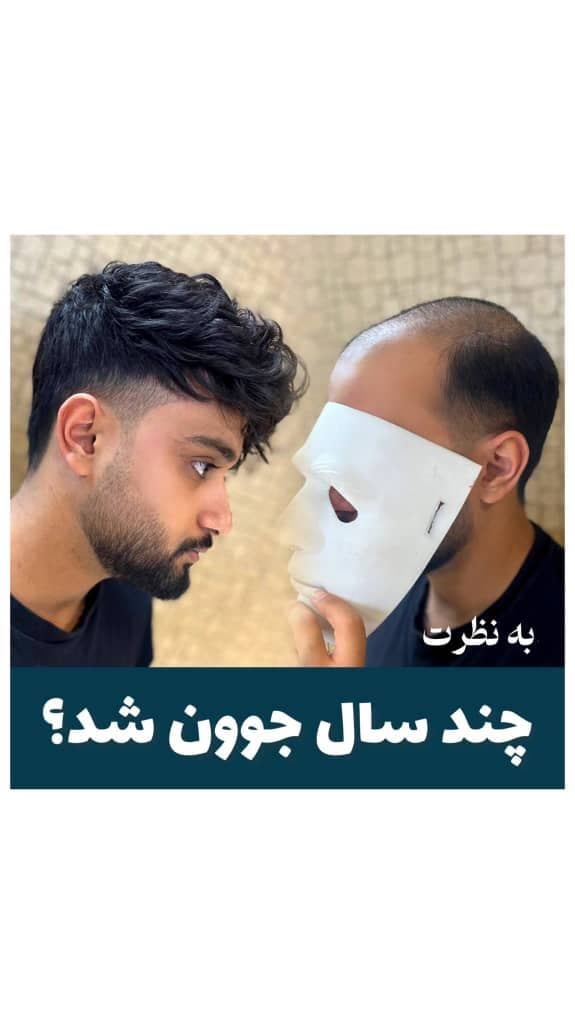 پروتز مو دکتر حمید ولیخانی در اصفهان