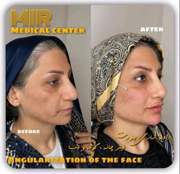 کلینیک زیبایی میر در زعفرانیه تهران