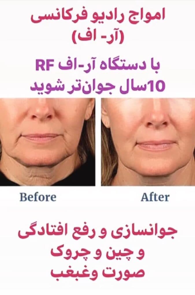 مرکز لاغری تضمینی و تخصصی آروشا در اندیشه شهریار