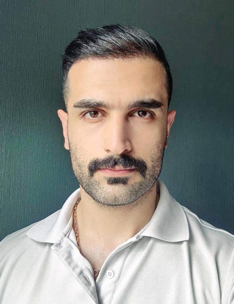 مرکز کاشت مو و ابرو ملیسا در زعفرانیه