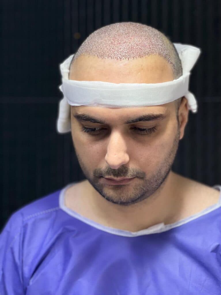 مرکز کاشت مو و ابرو ملیسا در زعفرانیه