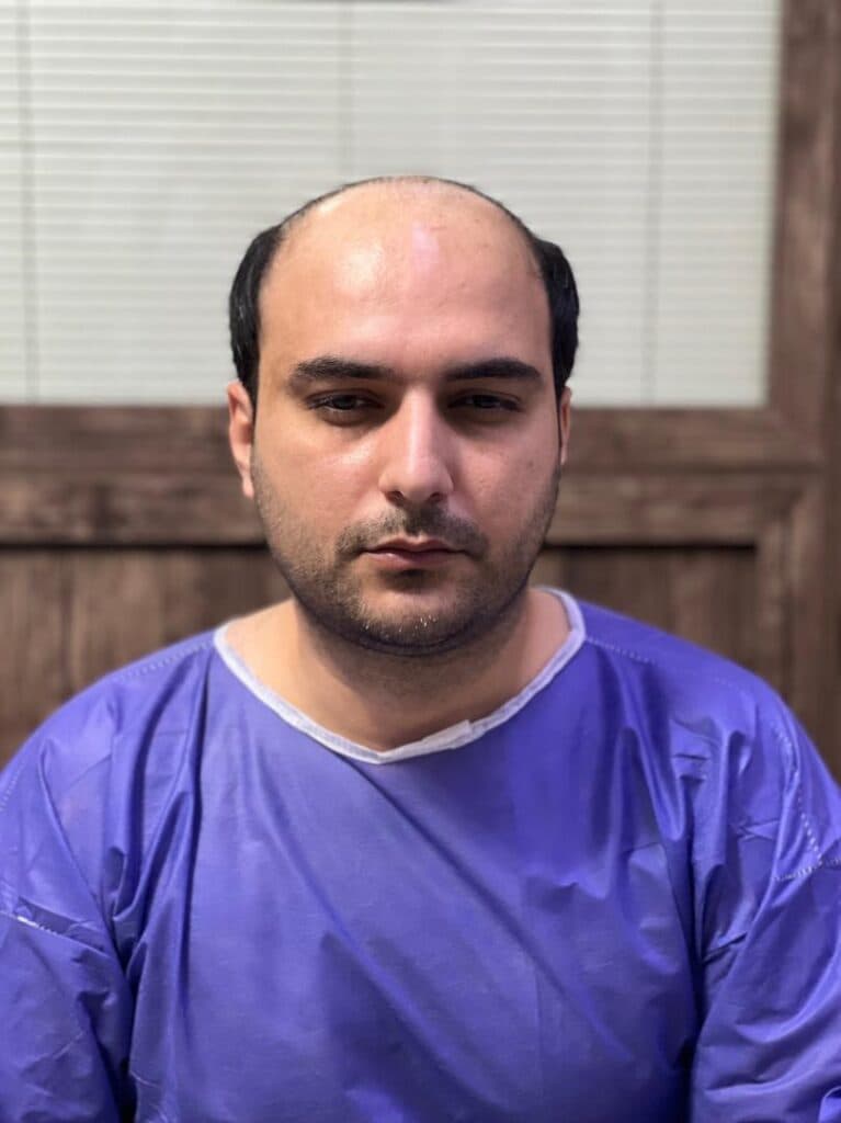 مرکز کاشت مو و ابرو ملیسا در زعفرانیه