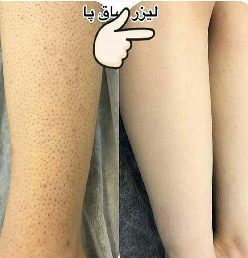 آموزش و خدمات زیبایی زیبا رویان سارا نیسی در اهواز