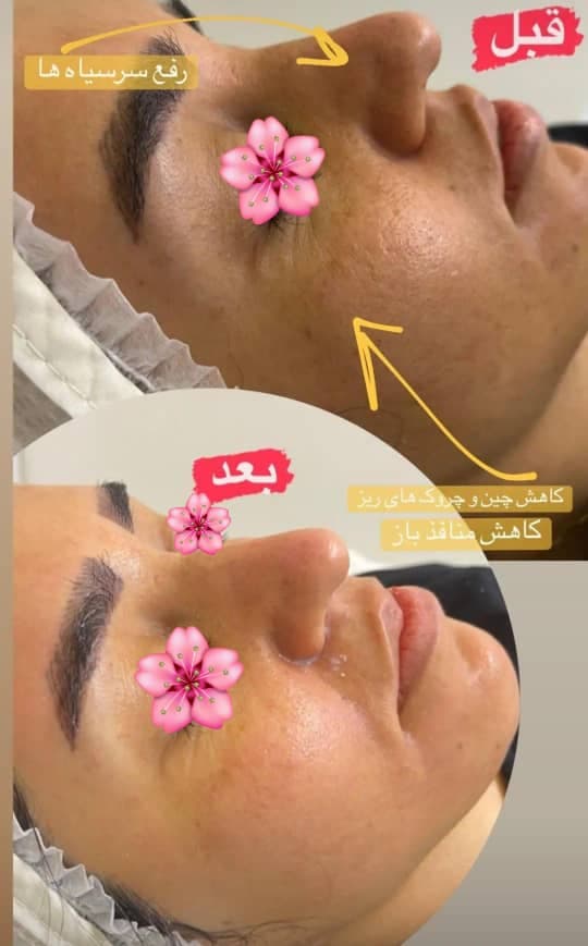 آموزش و خدمات تخصصی پاکسازی پوست لیلا محمدیان در اهواز
