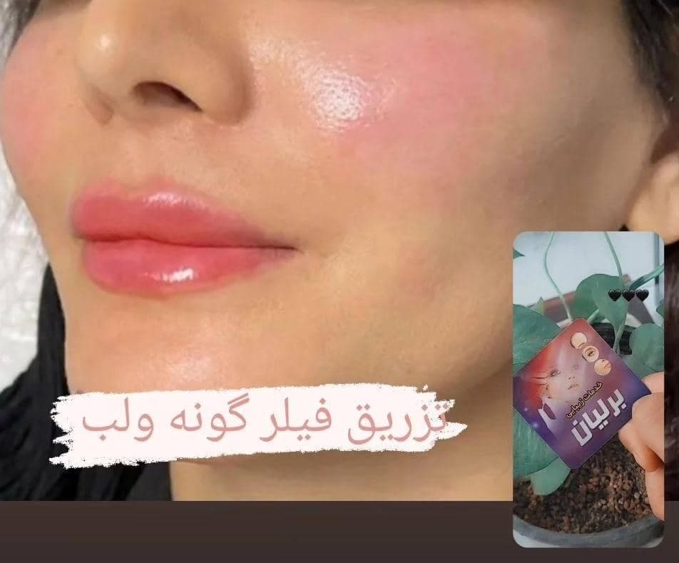 کلینیک زیبایی پوست و مو برلیان در خوزستان