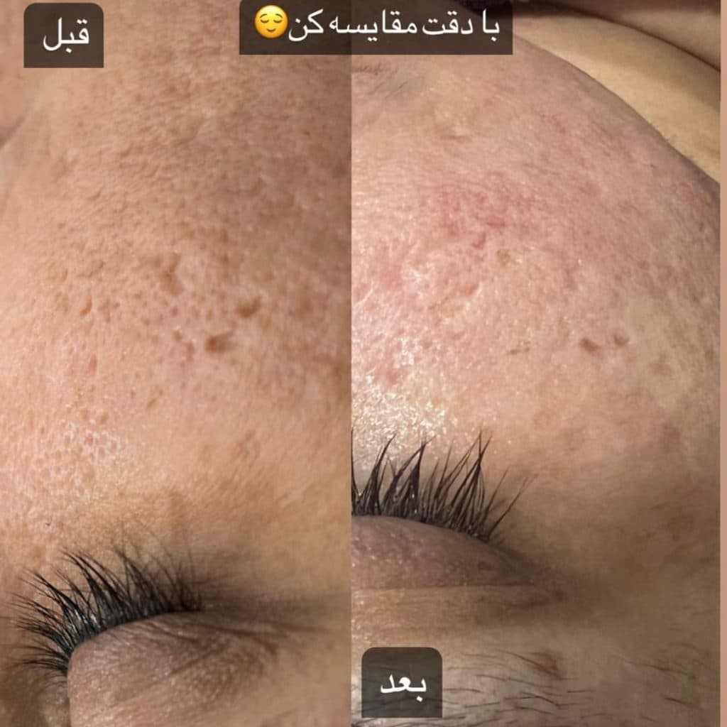 مرکز تخصصی فیشیال پوست فاطمه فخیره در زابل