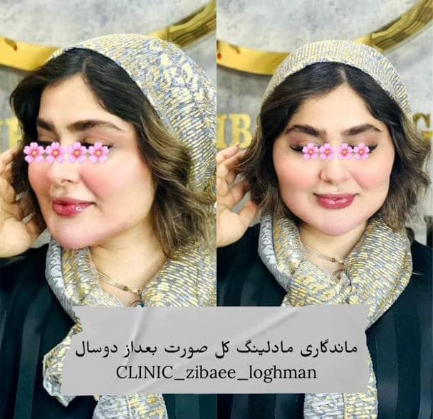 کلینیک زیبایی پوست و مو لقمان در شوش دانیال