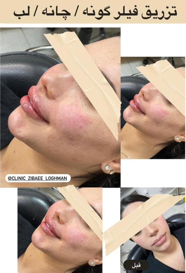 کلینیک زیبایی پوست و مو لقمان در شوش دانیال