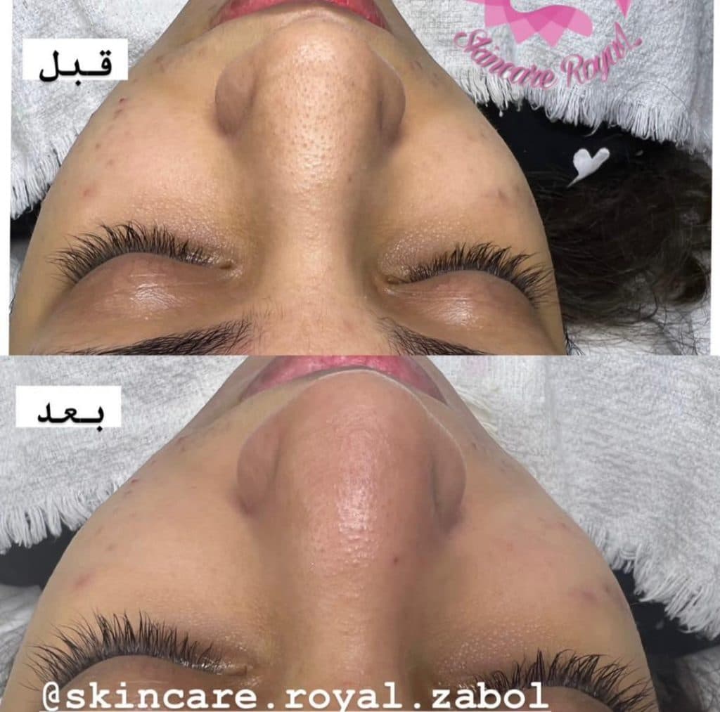 مرکز تخصصی فیشیال پوست فاطمه فخیره در زابل