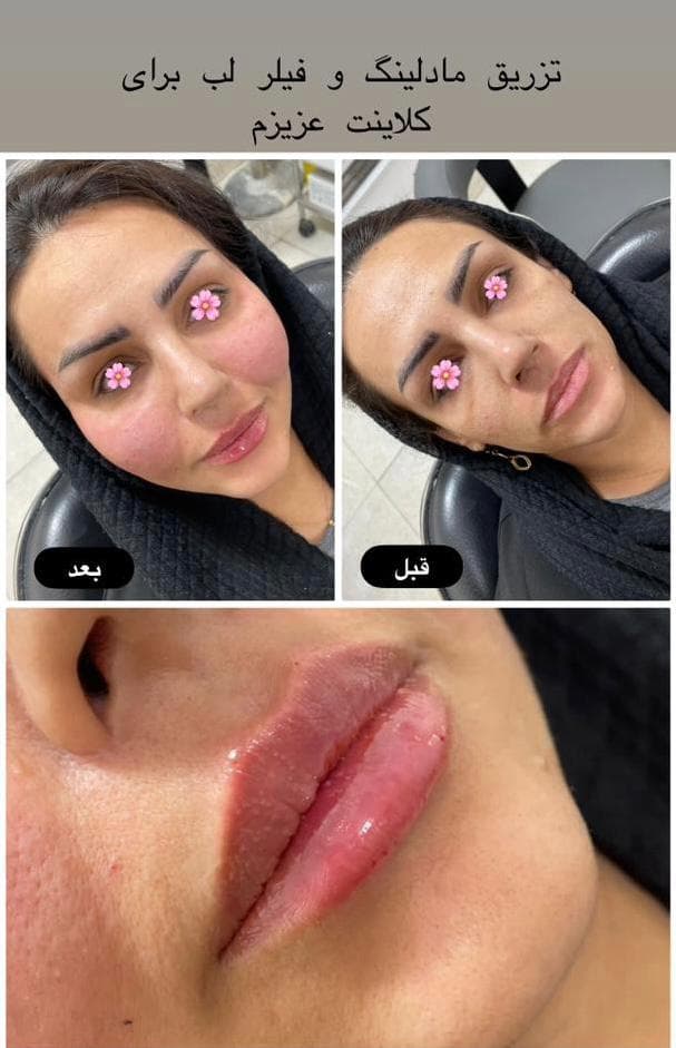کلینیک زیبایی پوست و مو لقمان در شوش دانیال