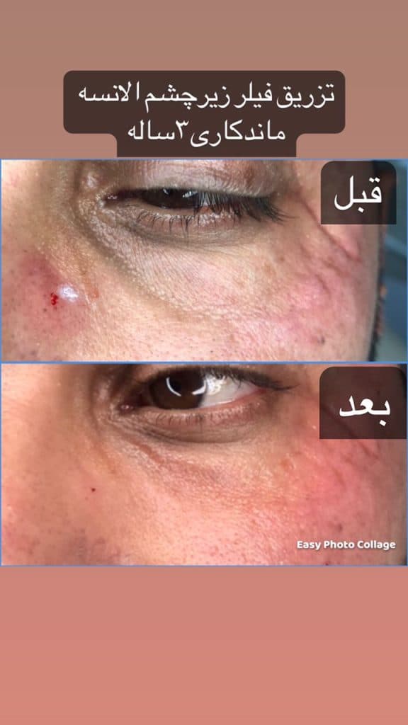 مرکز تخصصی زیبایی لیزر کیارش در رشت