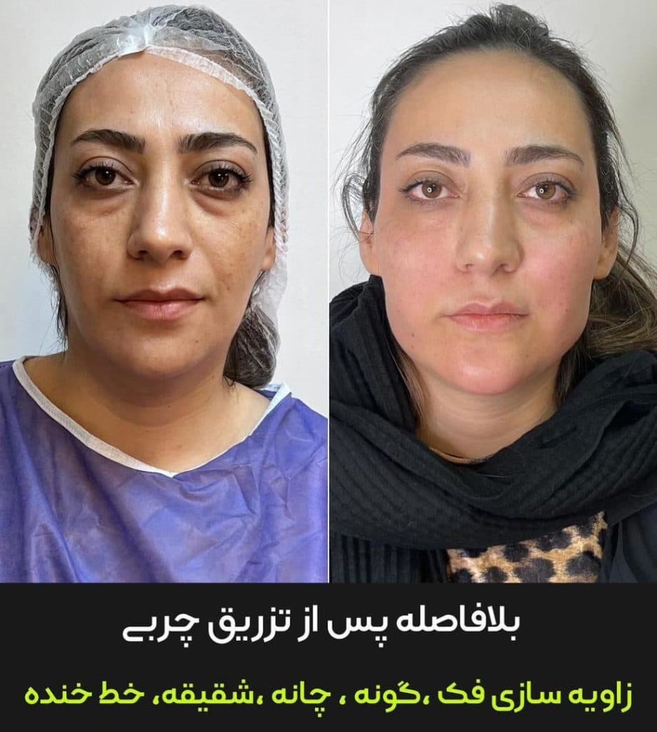 مطب زیبایی دکتر وحید عباس نژاد در صادقیه تهران