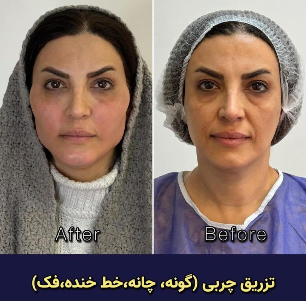 مطب زیبایی دکتر وحید عباس نژاد در صادقیه تهران