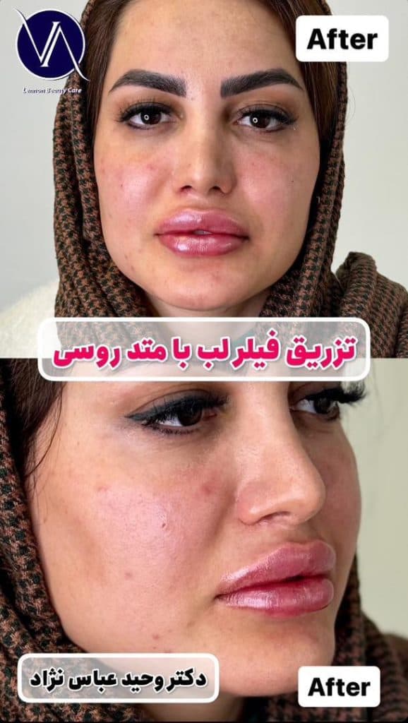 مطب زیبایی دکتر وحید عباس نژاد در صادقیه تهران