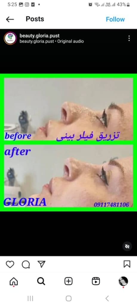 مطب زیبایی پوست و مو گلوریا در رشت