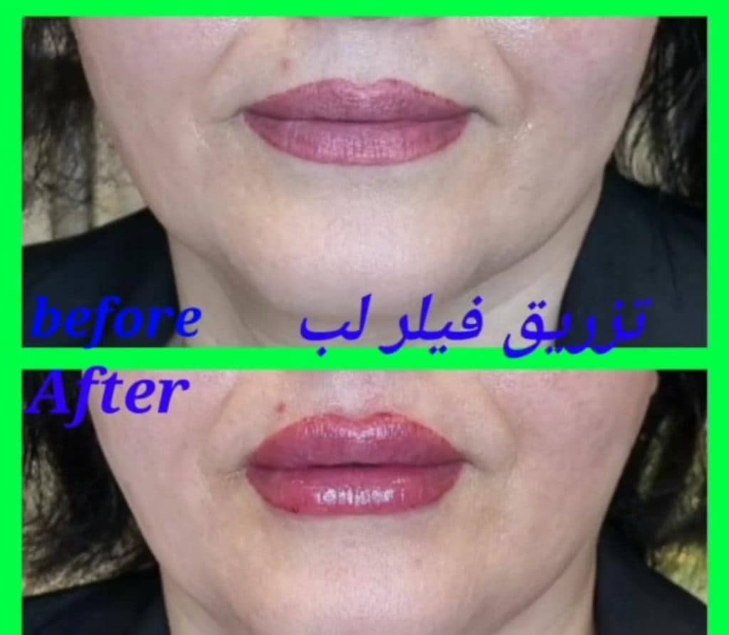 مطب زیبایی پوست و مو گلوریا در رشت