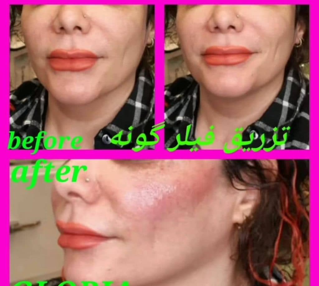 مطب زیبایی پوست و مو گلوریا در رشت