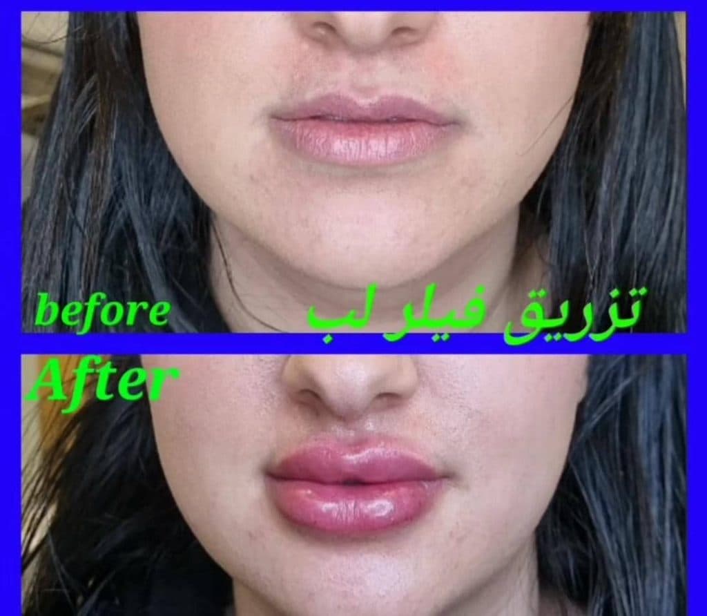 مطب زیبایی پوست و مو گلوریا در رشت