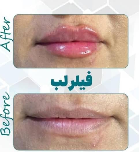 مطب تخصصی زیبایی پوست و مو سیما در گوهردشت کرج