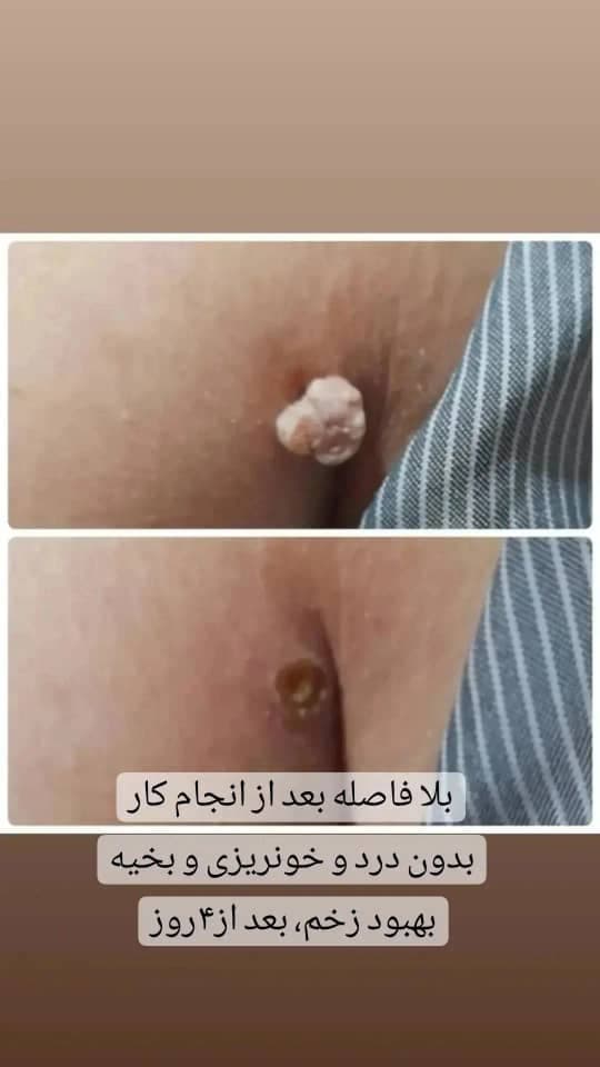 مطب زیبایی حورا در تهران