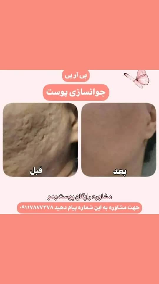 مطب زیبایی حورا در تهران