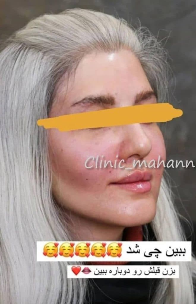 کلینیک زیبایی دکتر ماهان در ارومیه