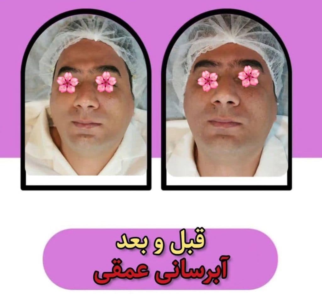 خدمات تخصصی پاکسازی پوست و فیشیال صورت شادی ملکشاهی در اصفهان