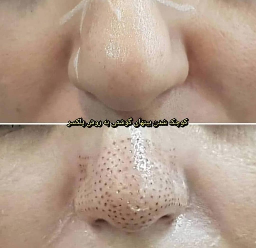 مرکز تخصصی لیزر طنین سلامت در کرمان