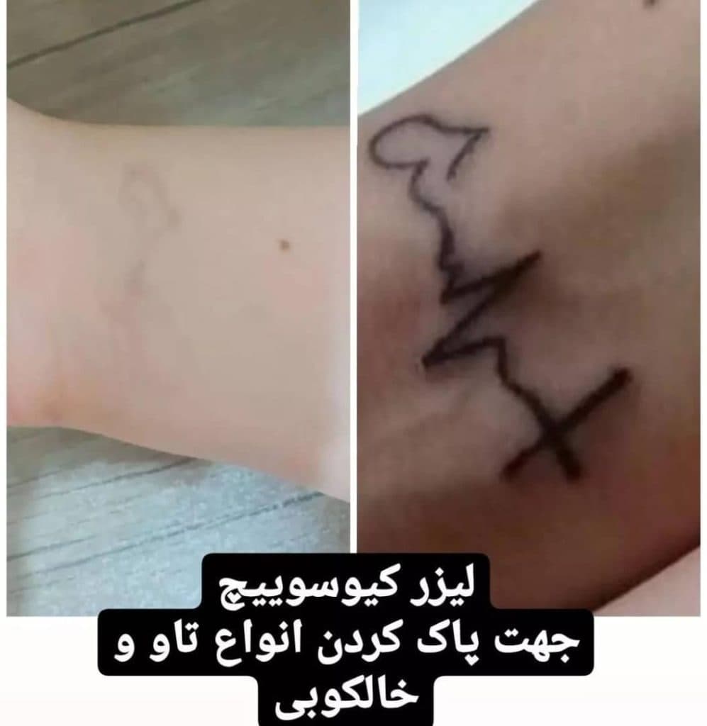 مرکز تخصصی لیزر طنین سلامت در کرمان