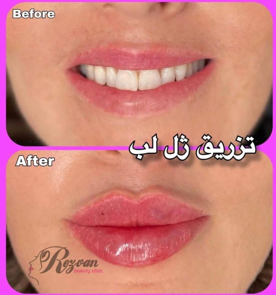 کلینیک زیبایی پوست و مو رضوان در نارمک تهران