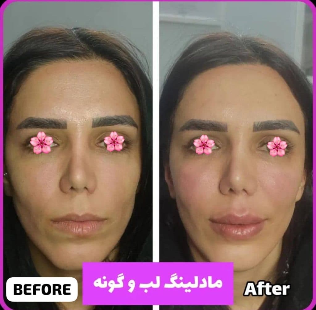 کلینیک زیبایی پوست و مو رضوان در نارمک تهران