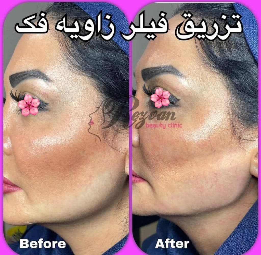 کلینیک زیبایی پوست و مو رضوان در نارمک تهران