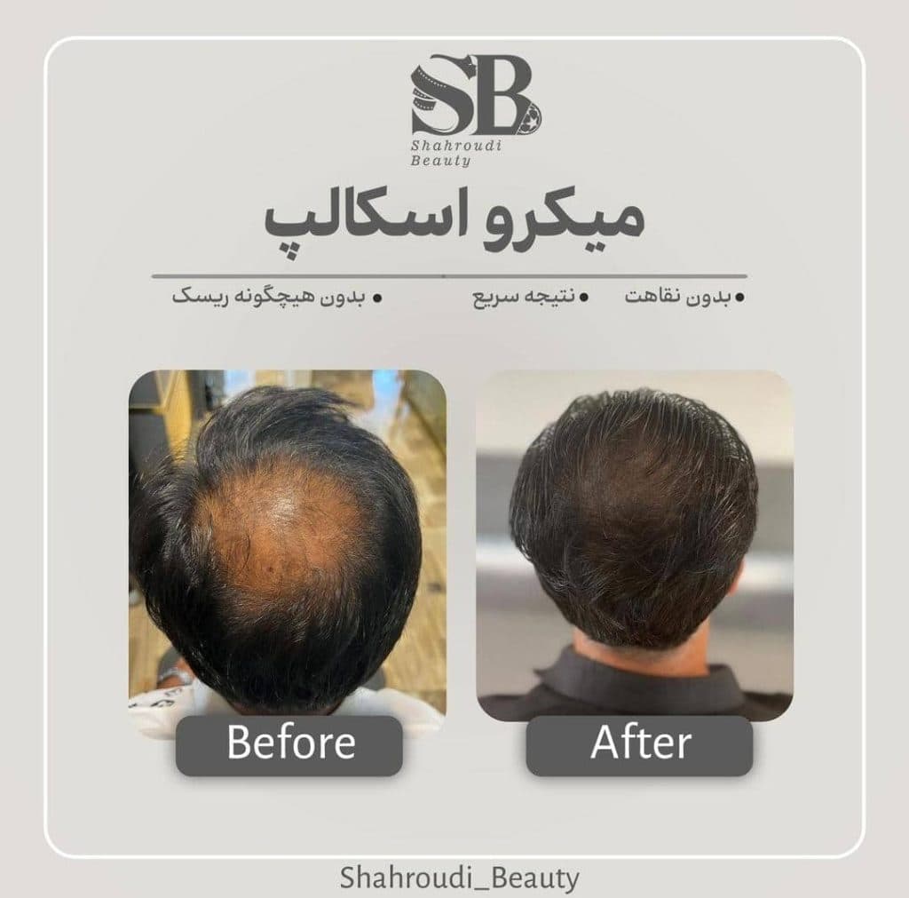 مرکز تخصصی میکرواسکالپ سر شاهرودی طب در سعادت آباد تهران
