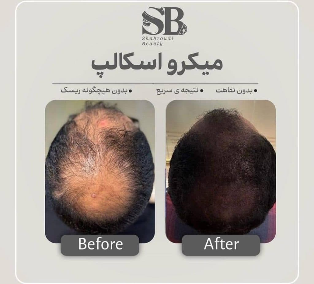 مرکز تخصصی میکرواسکالپ سر شاهرودی طب در سعادت آباد تهران