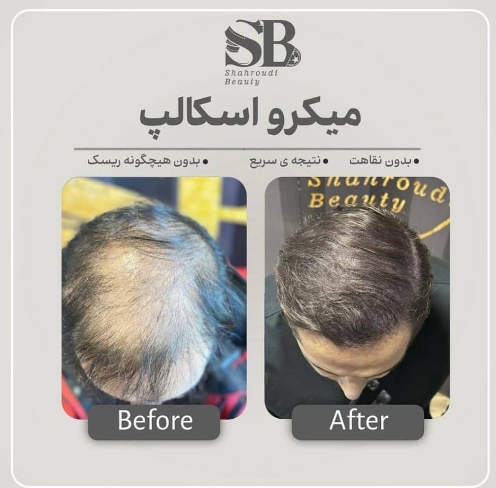 مرکز تخصصی میکرواسکالپ سر شاهرودی طب در سعادت آباد تهران